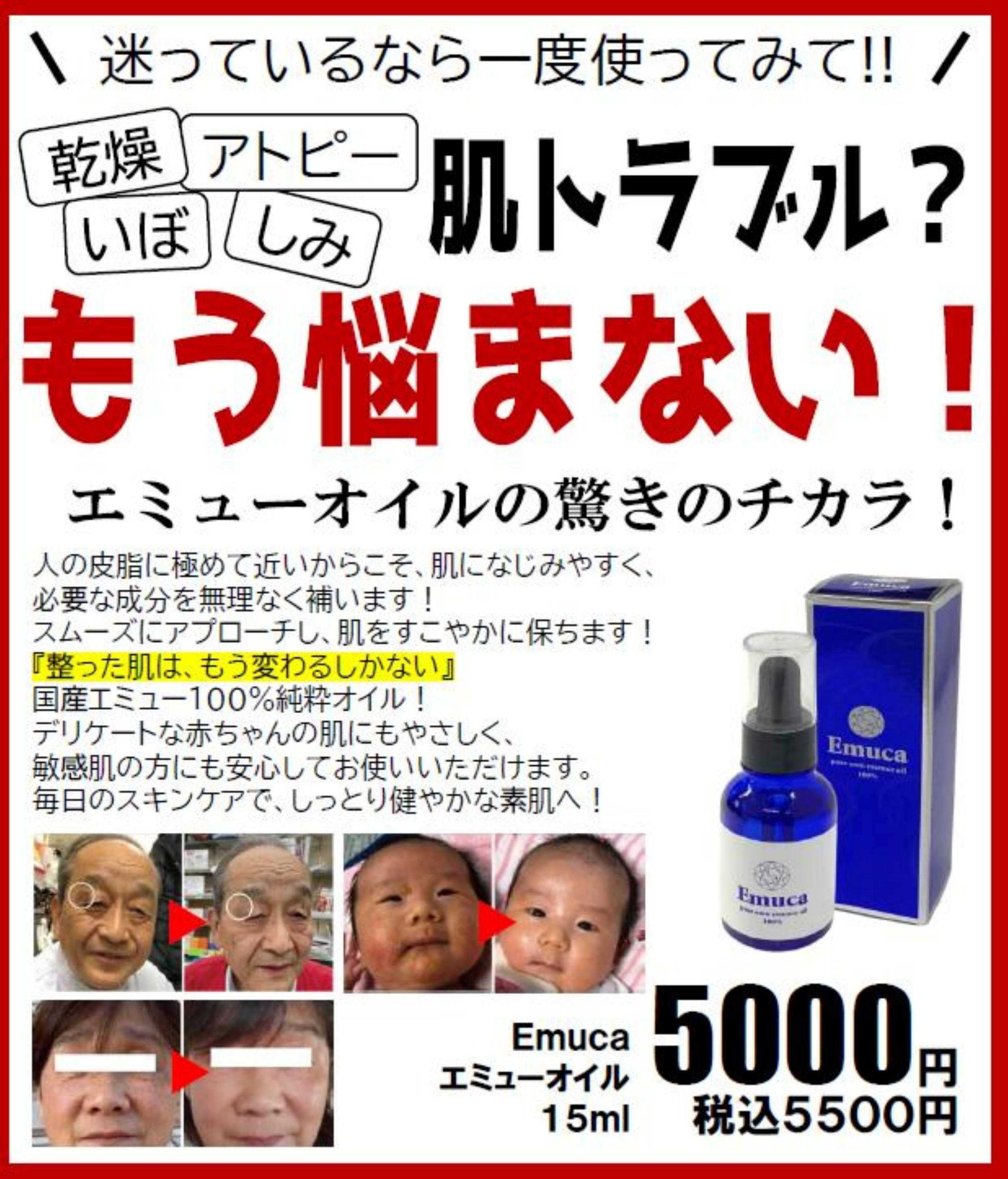 コメヤ薬局＋Mycra 肌トラブル？もう悩まない！